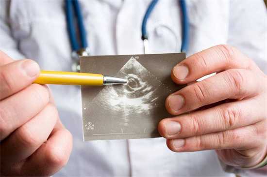 孕早期阴道炎：全面解析其对母婴健康的影响、成因及有效预防措施，以及如何